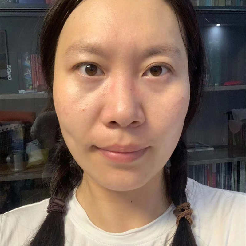 抗衰去皱案例